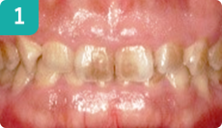 初めの状態の写真