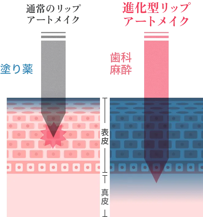 通常のアートメイクと進化型リップアートメイクの比較