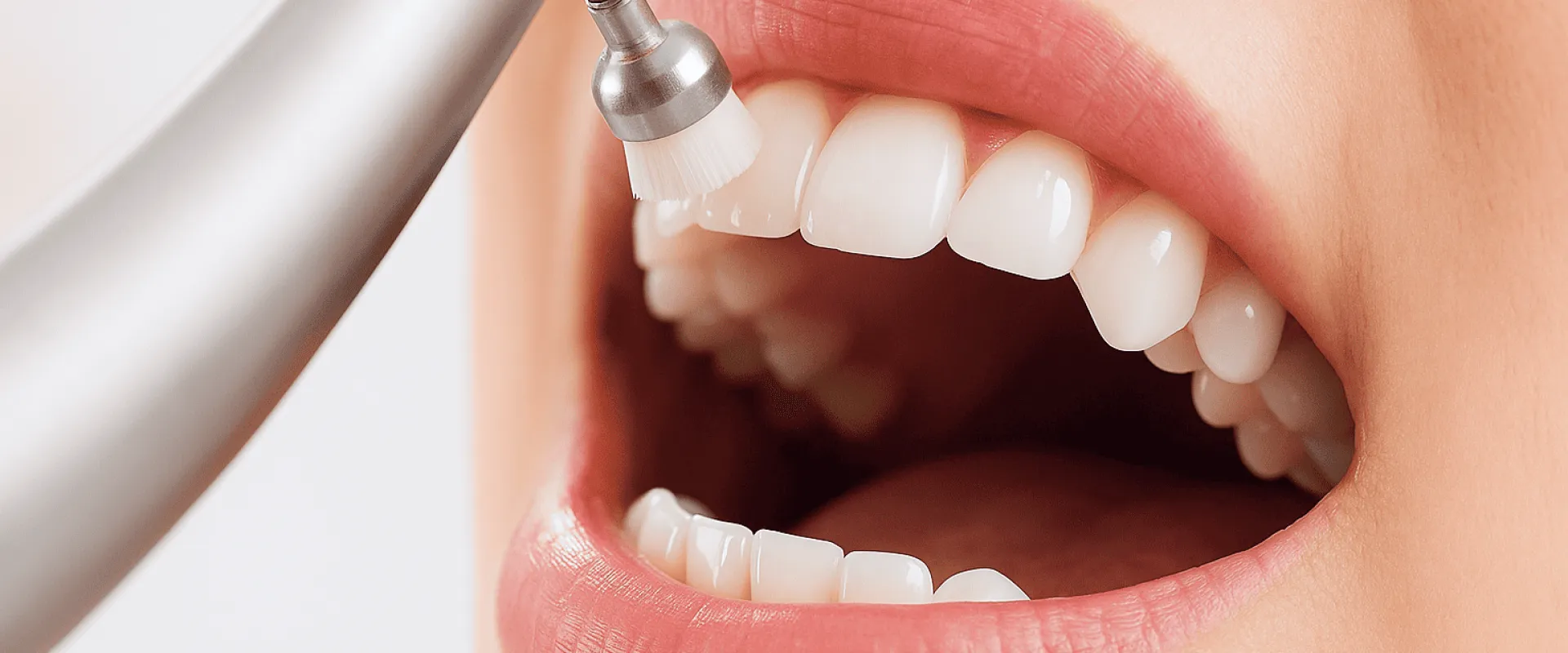 予防歯科/クリーニング