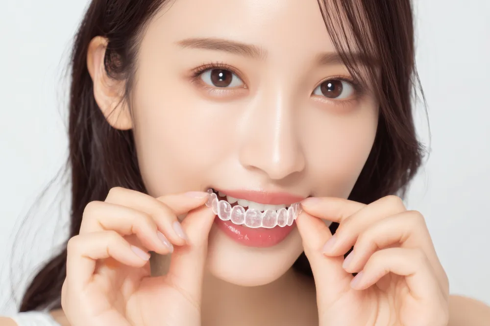 3Dデジタルマウスピース矯正