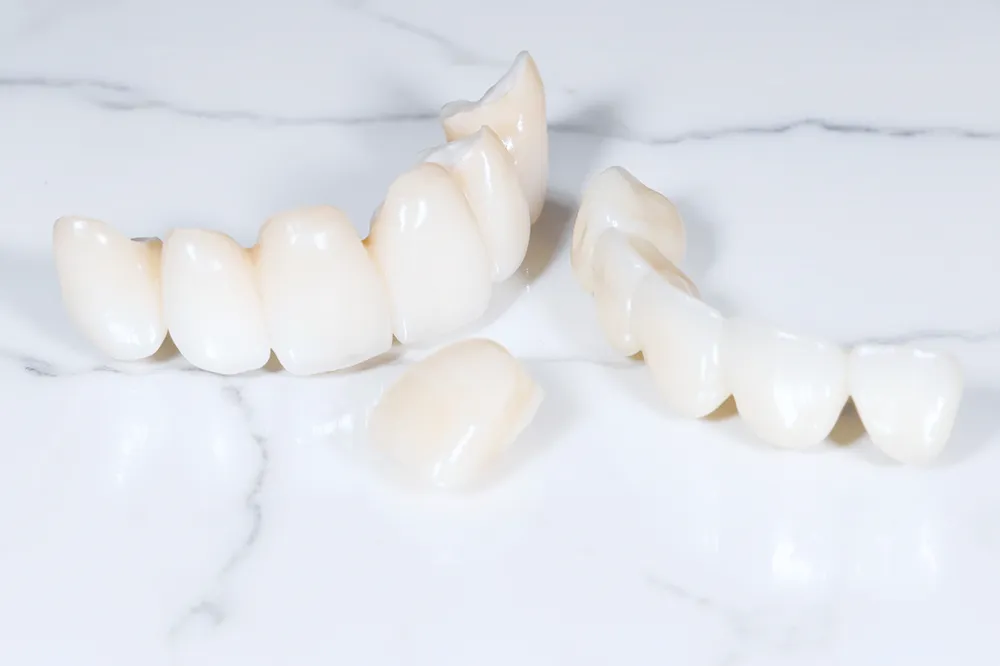 審美歯科の考え方