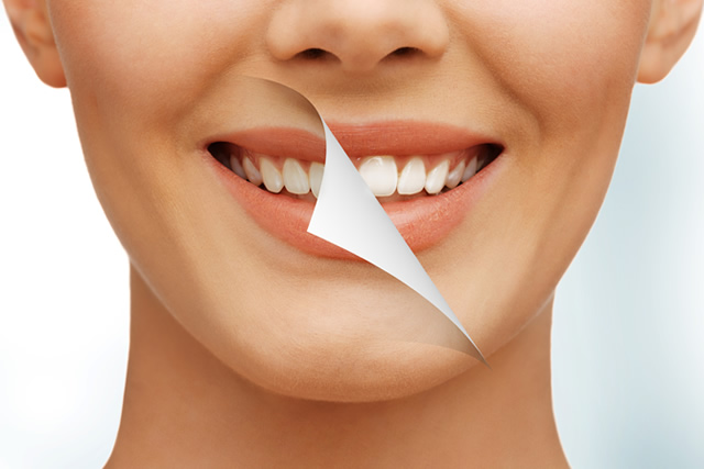 歯のマニキュアとホワイトニングって何が違うの？