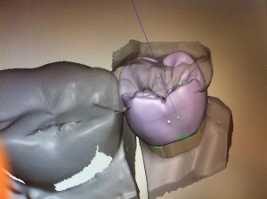 東京の歯科技工所に見学について専門の歯科医が解説