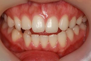 東京でホワイトニングに興味がある方は丸の内帝劇デンタルクリニックがおすすめ