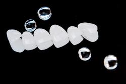 削らないラミネートベニアは何回で出来ますか