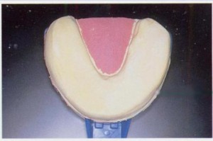 ホワイトニングは男子に人気！東京丸の内の歯科医が徹底解説！