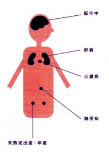 歯周病が全身に及ぼす影響