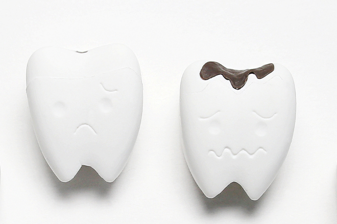 ラミネートベニアは虫歯になりやすい？適切なケアで長持ちさせよう