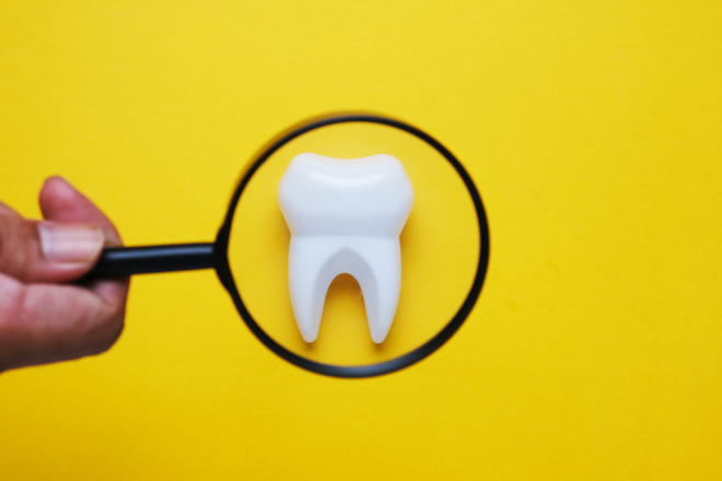 ラミネートベニアができない歯の特徴は？対策方法や症例紹介も