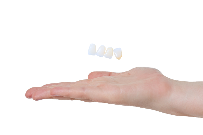 前歯のすきっ歯を治療する方法は？ラミネートベニアがおすすめな理由について解説