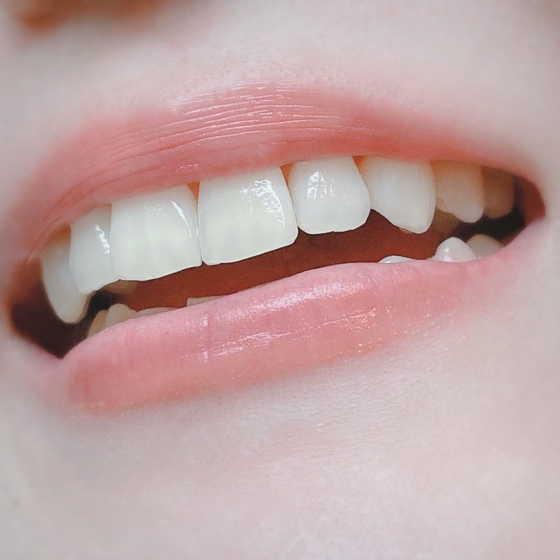 歯科医が教えるリップアートメイクの費用相場と選び方完全ガイド